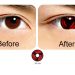 Softlens Anime Sharingan 14.2mm