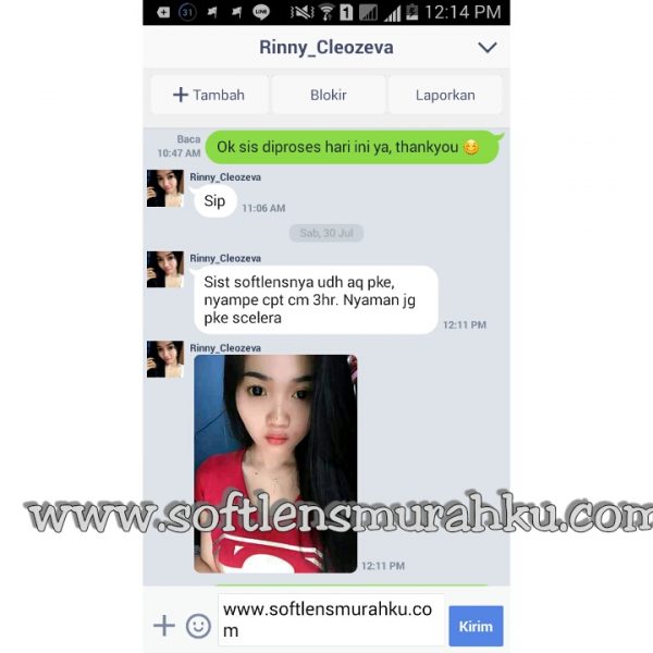 testimoni sclera sis rinay