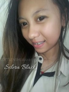 review sclera (2)