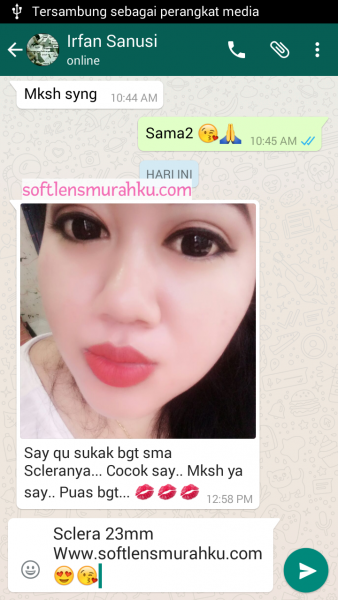 review sclera sis irfan sanusi