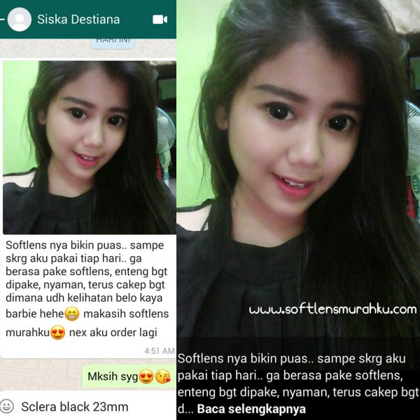 review sclera sis sika destiana