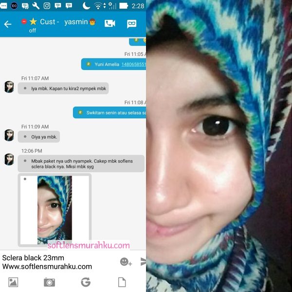 review sclera sis yasmin