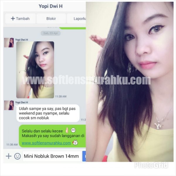 testimoni-nobluk-mini-sis-yopi