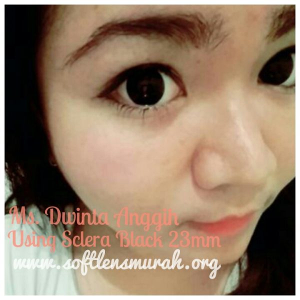 testimoni-sclera-black-ms-dwinta