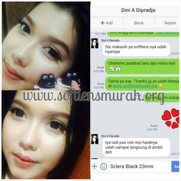 testimoni-sclera-sis-dini