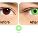 Softlens GEO Animation & Crazy Lens