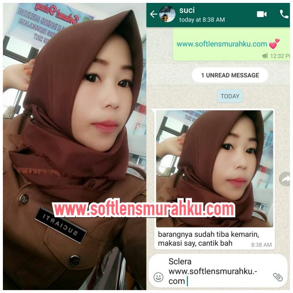 review sclera sis suci