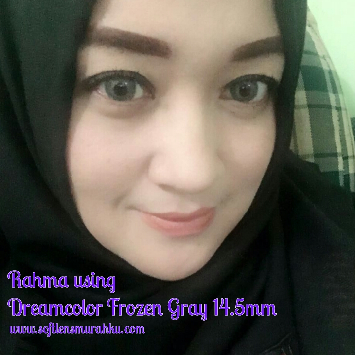 testimoni-frozen-sis-rahma